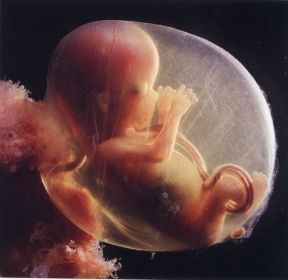 Carnets d'un Passeur Les foetus rêvent ils d'embryons ovins ? 